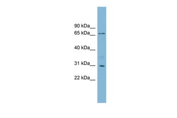 TBCCD1 Rabbit Polyclonal Antibody