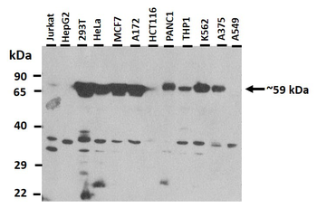 RIC8B Rabbit Polyclonal Antibody
