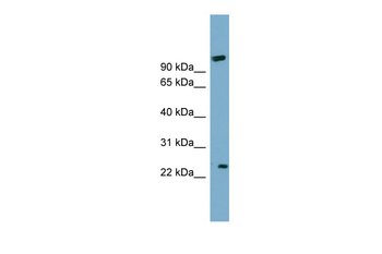 ARL8B Rabbit Polyclonal Antibody