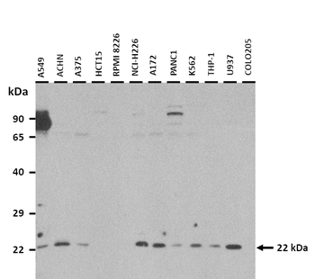 ARL8B Rabbit Polyclonal Antibody