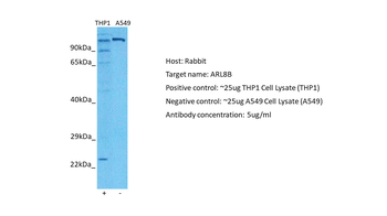 ARL8B Rabbit Polyclonal Antibody