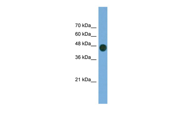 ARFGAP1 Rabbit Polyclonal Antibody