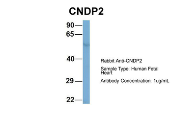 CNDP2 Rabbit Polyclonal Antibody