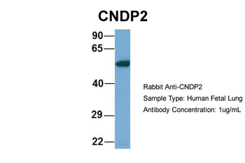 CNDP2 Rabbit Polyclonal Antibody