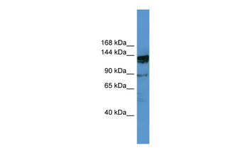 OGDHL Rabbit Polyclonal Antibody