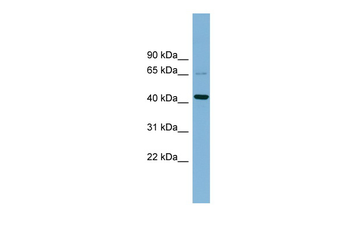 UEVLD Rabbit Polyclonal Antibody