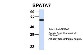 SPATA7 Rabbit Polyclonal Antibody