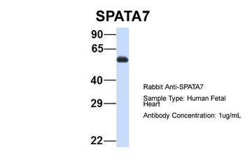 SPATA7 Rabbit Polyclonal Antibody
