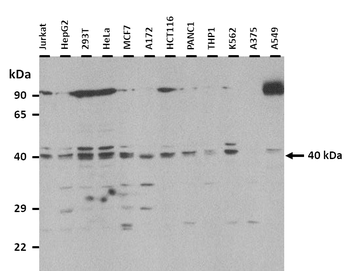 CENPN Rabbit Polyclonal Antibody