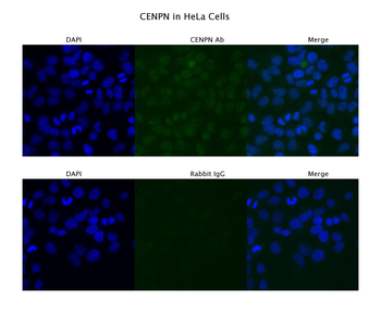 CENPN Rabbit Polyclonal Antibody
