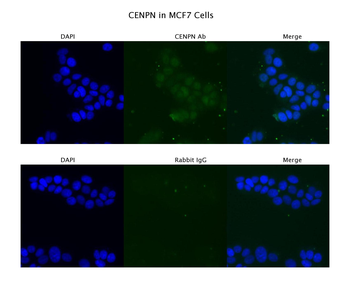 CENPN Rabbit Polyclonal Antibody