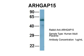 ARHGAP15 Rabbit Polyclonal Antibody