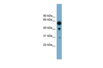 ARHGAP15 Rabbit Polyclonal Antibody
