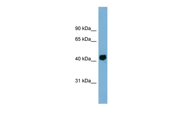 KIAA1704 Rabbit Polyclonal Antibody
