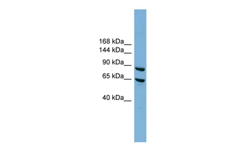 EXOC6 Rabbit Polyclonal Antibody
