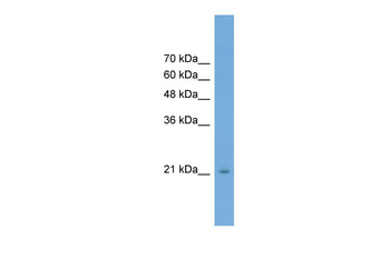 RAB25 Rabbit Polyclonal Antibody