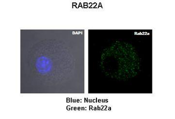 RAB22A Rabbit Polyclonal Antibody
