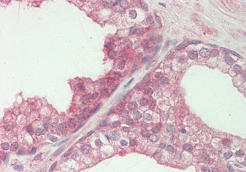 Wdfy1 Rabbit Polyclonal Antibody