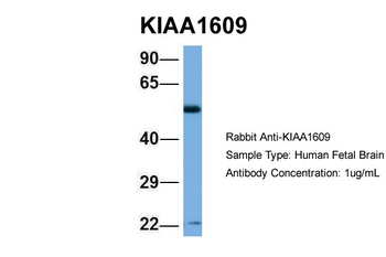 MEAK7 Rabbit Polyclonal Antibody