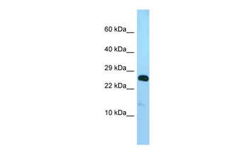 Ndufv2 Rabbit Polyclonal Antibody