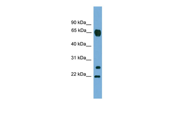 MMP26 Rabbit Polyclonal Antibody