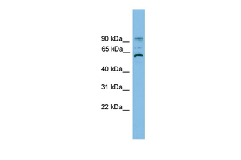 ANKRD5 Rabbit Polyclonal Antibody