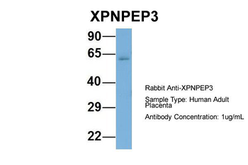 XPNPEP3 Rabbit Polyclonal Antibody