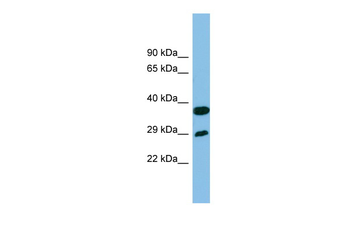 RTP4 Rabbit Polyclonal Antibody
