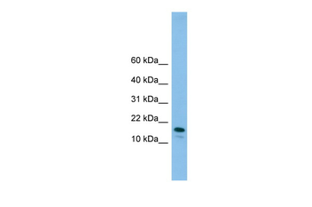 GREM2 Rabbit Polyclonal Antibody