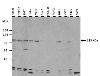 USP36 Rabbit Polyclonal Antibody