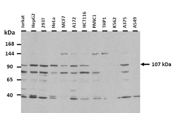 MATN2 Rabbit Polyclonal Antibody