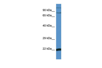 Nfkbiz Rabbit Polyclonal Antibody