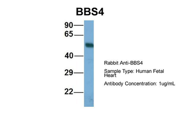 BBS4 Rabbit Polyclonal Antibody