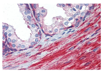 MYL6 Rabbit Polyclonal Antibody