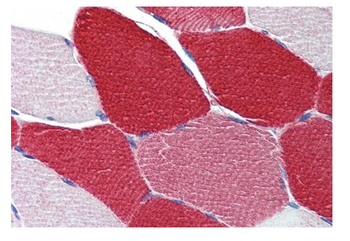 MYL6 Rabbit Polyclonal Antibody