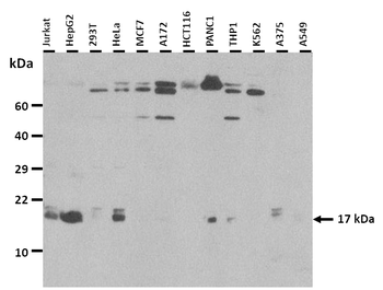 MYL6 Rabbit Polyclonal Antibody