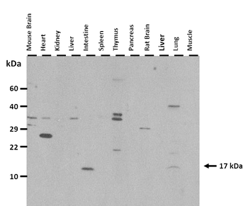 MYL6 Rabbit Polyclonal Antibody