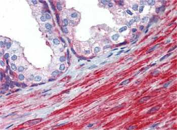 MYL6 Rabbit Polyclonal Antibody