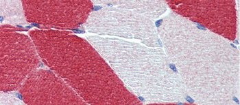 MYL6 Rabbit Polyclonal Antibody