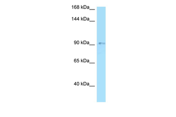 OPA1 Rabbit Polyclonal Antibody
