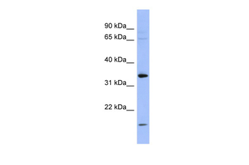 PYCR1 Rabbit Polyclonal Antibody