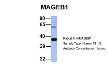 MAGEB1 Rabbit Polyclonal Antibody