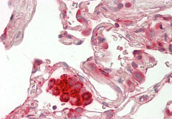 ASAH1 Rabbit Polyclonal Antibody