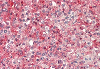 ASAH1 Rabbit Polyclonal Antibody