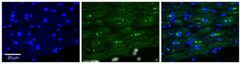 ASAH1 Rabbit Polyclonal Antibody
