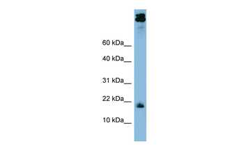 ASAH1 Rabbit Polyclonal Antibody