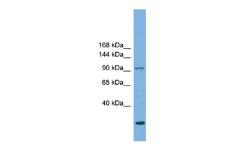 EXOC1 Rabbit Polyclonal Antibody