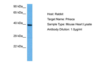 PRKACA Rabbit Polyclonal Antibody