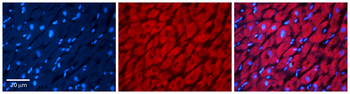 PRKACA Rabbit Polyclonal Antibody