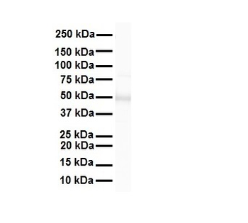 FOXA1 Rabbit Polyclonal Antibody